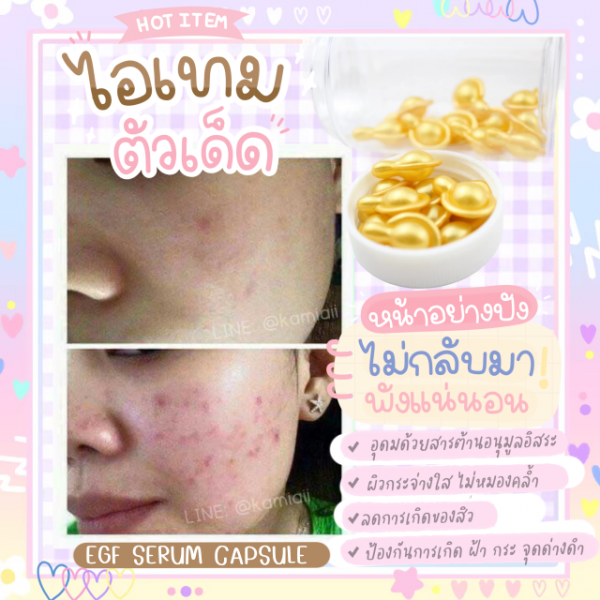 EGF Gold สูตรรักษาผิวหน้าแทนการฉีด ขาวเนียนกว่าฉีดสะกิด แคปซูลเซรั่มเซลล์ต้นกำเนิดผิวหนัง - Image 3