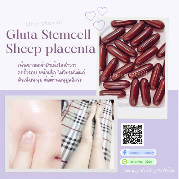 Stemcell Overwhite Gluta 20,000mg. ขาวหน้าเด็ก ผิวเนียนออร่า ลดฝ้ากระริ้วรอย กลูต้ารกแกะสเต็มเซลล์โอเวอร์ไวท์ - Image 5