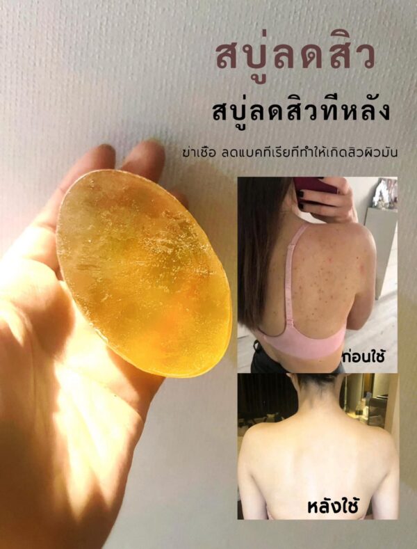 [TESTER] สบู่ดูแลเรื่องสิว คุมมัน สารสกัดเสถียร ลดแบคทีเรีย เคลียร์ผิวใสเรียบเนียน  ใช้ได้ทั้งหน้าและตัว อ่อนโยนไม่ระคายเคือง AC DOCTOR SOAP