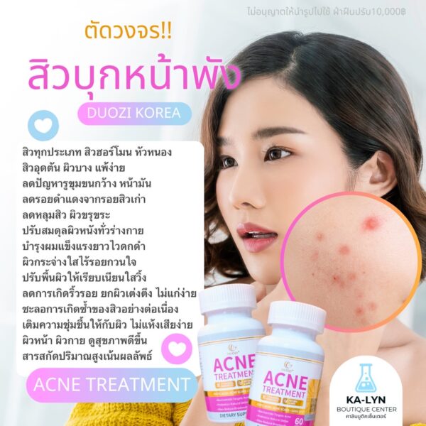 🇺🇸USA [มีสินค้า🇹🇭] DUOZI ACNE TREATMENT | ดูแลสิวและผิวโดยเฉพาะ ล.ดสิว รอยดำ หลุม ลดความมันลดรูขุมขน ผิวใสสวยเนียนวิบ อาหารเสริมสำหรับสิวจากอเมริกา - Image 2